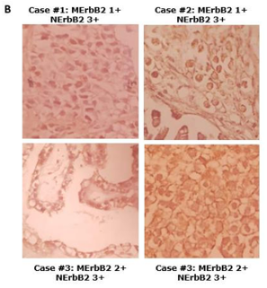 4 representative cases of IHC are shown. 400X magnification